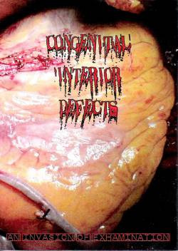 Congenital Interior Defects : An Invasion of Exhamination